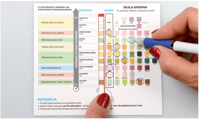 Badania moczu - interpretacja wyników